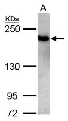 Western Blot: TOP2B Antibody [NBP2-20684] - Sample (30 ug of whole cell lysate) A: Jurkat 5% SDS PAGE gel, diluted at 1:3000.