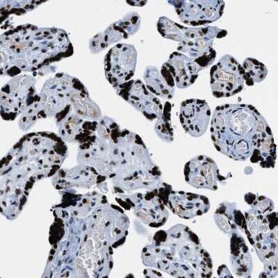 Immunohistochemistry-Paraffin: Topoisomerase I Antibody [NBP1-90365] - Staining of human placenta shows very strong nuclear positivity in trophoblastic cells.