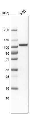 Western Blot: Topoisomerase I Antibody [NBP1-90365] - Analysis in human cell line HELA.