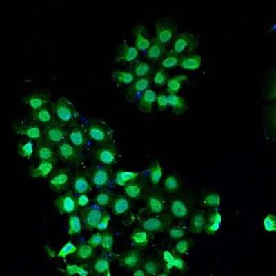 Immunocytochemistry/Immunofluorescence: Topoisomerase III alpha Antibody [NBP2-67219] - Staining TOP3A in A431 cells (green). Cells were fixed in paraformaldehyde, permeabilised with 0.25% Triton X100/PBS and counterstained with DAPI in order to highlight the nucleus (blue).