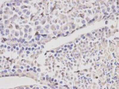 Immunohistochemistry-Paraffin: Topoisomerase III alpha Antibody [NBP2-67219] - Analysis of paraffin-embedded mouse testis tissue using anti- TOP3A rabbit polyclonal antibody.