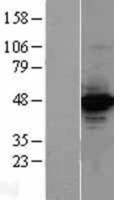 Western Blot: Torc2 Overexpression Lysate (Adult Normal) [NBL1-09492] Left-Empty vector transfected control cell lysate (HEK293 cell lysate); Right -Over-expression Lysate for Torc2.