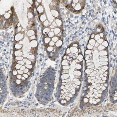 Immunohistochemistry-Paraffin Torsin 1B Antibody