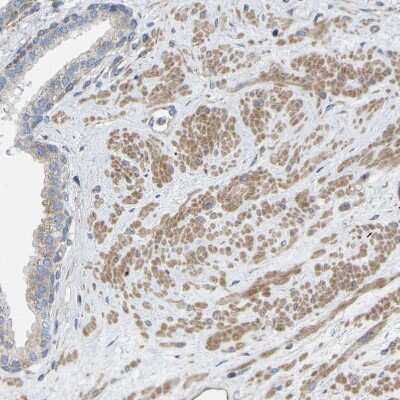 Immunohistochemistry-Paraffin Torsin 1B Antibody