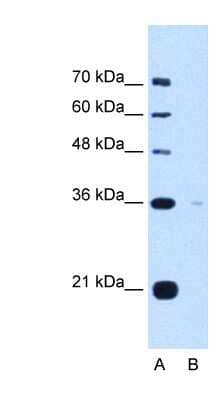 Western Blot: Torsin 1B Antibody [NBP1-62568] - HepG2 cell lysate, concentration 5.0ug/ml.