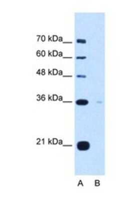 Western Blot: Torsin 1B Antibody [NBP1-69580] - This Anti-TOR1B antibody was used in Western Blot of HepG2 tissue lysate at a concentration of 5ug/ml.