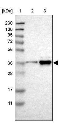 Western Blot: Torsin 1B Antibody [NBP1-84984] - Lane 1: Marker  [kDa] 230, 130, 95, 72, 56, 36, 28, 17, 11.  Lane 2: Human cell line RT-4.  Lane 3: Human cell line U-251MG sp