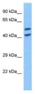 Western Blot: Torsin 1B Antibody [NBP3-10005] - Western blot analysis of Torsin 1B in Human DLD1 Whole Cell. Antibody dilution at 1.0ug/ml