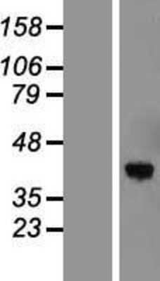 Western Blot: Torsin 1B Overexpression Lysate (Adult Normal) [NBL1-17198] Left-Empty vector transfected control cell lysate (HEK293 cell lysate); Right -Over-expression Lysate for Torsin 1B.