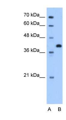 Western Blot Torsin 2A Antibody - BSA Free