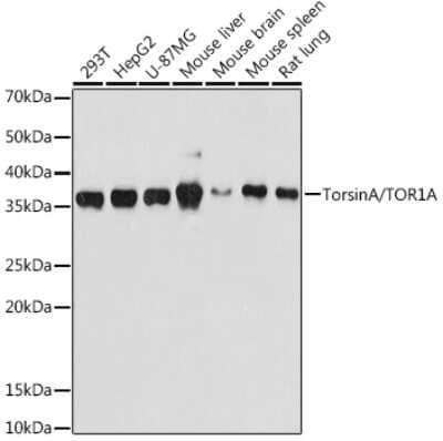 Western Blot: Torsin A Antibody (4Q2I9) [NBP3-16831] - Western blot analysis of extracts of various cell lines, using Torsin A antibody (NBP3-16831) at 1:500 dilution. Secondary antibody: HRP Goat Anti-Rabbit IgG (H+L) at 1:10000 dilution. Lysates/proteins: 25ug per lane. Blocking buffer: 3% nonfat dry milk in TBST. Detection: ECL Basic Kit. Exposure time: 180s.