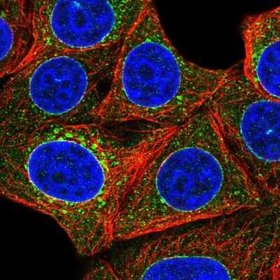 Immunocytochemistry/Immunofluorescence: Torsin A Antibody [NBP2-56137] - Staining of human cell line MCF7 shows localization to nuclear membrane & vesicles. Antibody staining is shown in green.