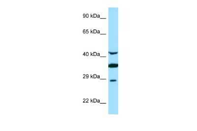 Western Blot: Torsin A Antibody [NBP2-85972] - WB Suggested Anti-TOR1A Antibody. Titration: 1.0 ug/ml. Positive Control: Fetal Brain