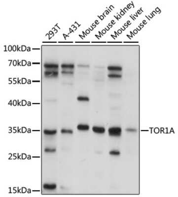 Western Blot: Torsin A Antibody [NBP2-95160] - Analysis of extracts of various cell lines, using Torsin A at 1:1000 dilution. Secondary antibody: HRP Goat Anti-Rabbit IgG (H+L) at 1:10000 dilution. Lysates/proteins: 25ug per lane. Blocking buffer: 3% nonfat dry milk in TBST. Detection: ECL Basic Kit . Exposure time: 15s.