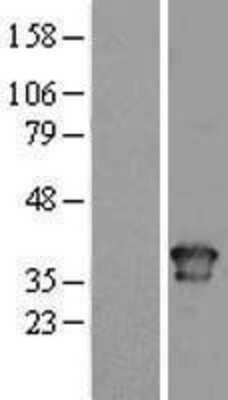 Western Blot: Torsin A Overexpression Lysate (Adult Normal) [NBL1-17196] Left-Empty vector transfected control cell lysate (HEK293 cell lysate); Right -Over-expression Lysate for Torsin A.