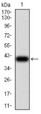 Western Blot: Toxoplasma gondii SAG2 Antibody (1D12B8) [NBP2-61907] - Analysis using SAG2 mAb against Toxoplasma gondii surface antigen 2B SAG2 (AA: 1-130) recombinant protein. (Expected MW is 39.3 kDa)