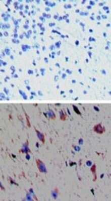 Immunohistochemistry-Paraffin: Trace Amine Receptor 1 Antibody [NBP2-24714] - Analysis of TAAR1 in paraffin-embedded formalin-fixed mouse brain tissue using a rabbit isotype control (top) and (bottom) at 5 ug/ml.