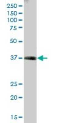 Western Blot: Transaldolase 1 Antibody [H00006888-B01P] - Analysis of TALDO1 expression in human kidney.