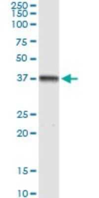 Western Blot: Transaldolase 1 Antibody [H00006888-D01P] - Analysis of TALDO1 expression in human pancreas.