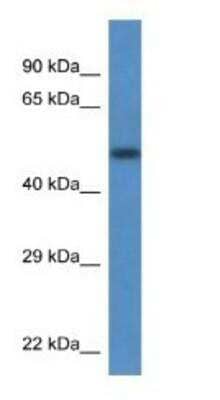 Western Blot: Transcobalamin II Antibody [NBP1-74220] - Mouse Pancreas Lysate 1.0 ug/ml, gel concentration 12%