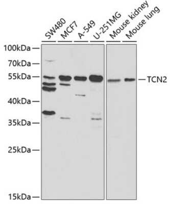 Western Blot: Transcobalamin II Antibody [NBP2-94355] - Analysis of extracts of various cell lines, using Transcobalamin II at 1:1000 dilution. Secondary antibody: HRP Goat Anti-Rabbit IgG (H+L) at 1:10000 dilution. Lysates/proteins: 25ug per lane. Blocking buffer: 3% nonfat dry milk in TBST. Detection: ECL Basic Kit . Exposure time: 30s.