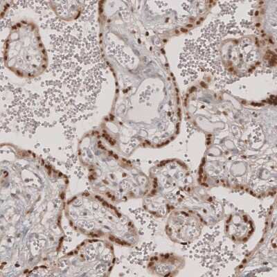 Immunohistochemistry-Paraffin: Transcription factor E3 Antibody [NBP1-89976] - Staining of human placenta shows moderate to strong nuclear positivity in trophoblastic cells.