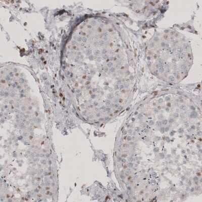 Immunohistochemistry-Paraffin: Transcription factor E3 Antibody [NBP1-89976] - Staining of human testis shows moderate nuclear positivity in a subset of cells in seminiferous ducts.