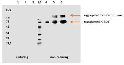 Western Blot: Transferrin Antibody (HTF-14) - Azide Free [NBP2-37718] - Human transferrin detected by the antibody.   1. hTransferrin; 5 ug/well (red. con.)   2. hTransferrin; 3 ug/well (red. con.)   3. hTransferrin; 1 ug/well (red. con.)   M. Low Range marker  4. hTransferrin; 1 ug/well (non-red. con.)   5. hTransferrin; 3 ug/well (non-red. con.)   6. hTransferrin; 5 ug/well (non-red. con.)