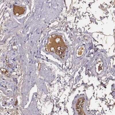 Immunohistochemistry-Paraffin: Transferrin Antibody [NBP1-87221] - Staining of human plasma shows moderate positivity.