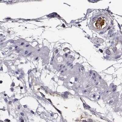 Immunohistochemistry-Paraffin: Transferrin Antibody [NBP1-87221] - Staining of human colon.