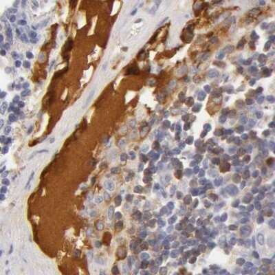 Immunohistochemistry-Paraffin: Transferrin Antibody [NBP1-87222] - Staining of human lymph node.