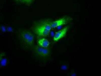 Immunocytochemistry/Immunofluorescence: Transferrin Antibody (OTI5G2) - Azide and BSA Free [NBP2-74583] - Staining of COS7 cells transiently transfected by pCMV6-ENTRY Transferrin.