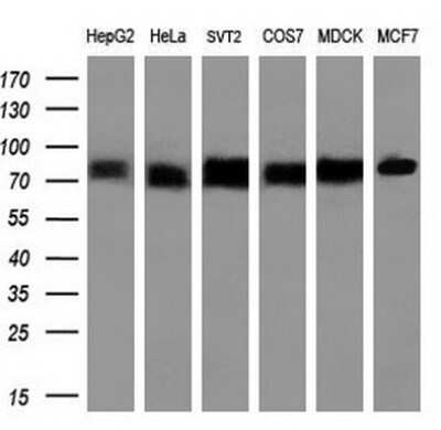 Western Blot: Transferrin Antibody (OTI5G2) - Azide and BSA Free [NBP2-74583] - Analysis of extracts (10ug) from 6 different cell lines by using anti-TF monoclonal antibody (1:1000).