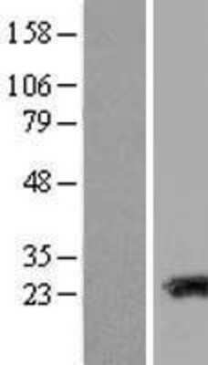 Western Blot: Transgelin-3 Overexpression Lysate (Adult Normal) [NBP2-10994] Left-Empty vector transfected control cell lysate (HEK293 cell lysate); Right -Over-expression Lysate for Transgelin-3.