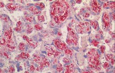Immunohistochemistry-Paraffin: Transgelin/TAGLN/SM22 alpha Antibody [NBP3-12108] - Formalin-Fixed, Paraffin-Embedded HIER human placenta using 10 mM sodium citrate buffer pH 6.