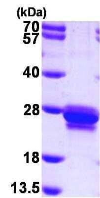 SDS-PAGE Recombinant Human Transgelin/TAGLN/SM22 alpha His Protein