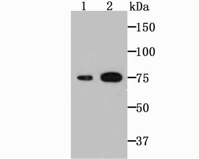 Western Blot: Transglutaminase 2/TGM2 Antibody (JU30-02) [NBP2-75687] - Analysis of Transglutaminase 2 on mouse placenta (1) and lung tissue lysates using anti-Transglutaminase 2 antibody at 1/500 dilution.