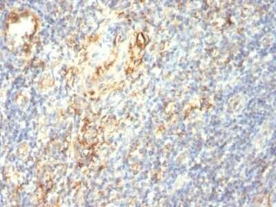 Immunohistochemistry-Paraffin: Transglutaminase 2/TGM2 Antibody (SPM358) - Azide and BSA Free [NBP2-47926] - Human Tonsil stained with Transglutaminase II Monoclonal Antibody (TGM2/419)