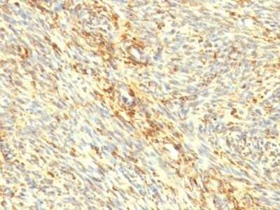 Immunohistochemistry-Paraffin: Transglutaminase 2/TGM2 Antibody (SPM358) - Azide and BSA Free [NBP2-47926] - Human Uterus stained with Transglutaminase II Monoclonal Antibody (TGM2/419)