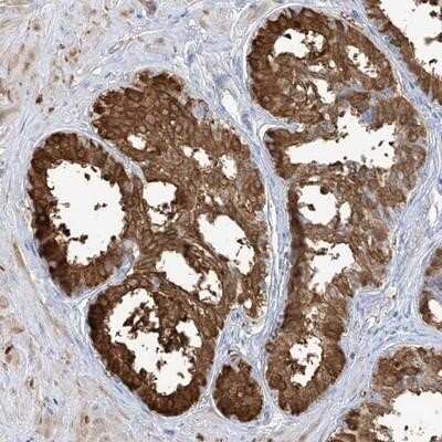 Immunohistochemistry-Paraffin: Transglutaminase 4/TGM4 Antibody [NBP1-86947] - Staining of human prostate shows strong cytoplasmic positivity in glandular cells.