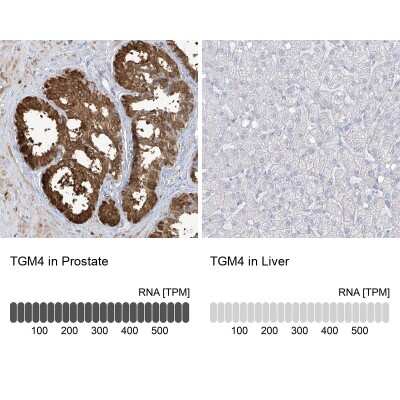 Immunohistochemistry-Paraffin: Transglutaminase 4/TGM4 Antibody [NBP1-86947] - Analysis in human prostate and liver tissues using NBP1-86947 antibody. Corresponding TGM4 RNA-seq data are presented for the same tissues.