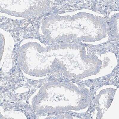 Immunohistochemistry-Paraffin: Transglutaminase 4/TGM4 Antibody [NBP1-86947] - Staining of human Endometrium shows no positivity in glandular cells as expected.