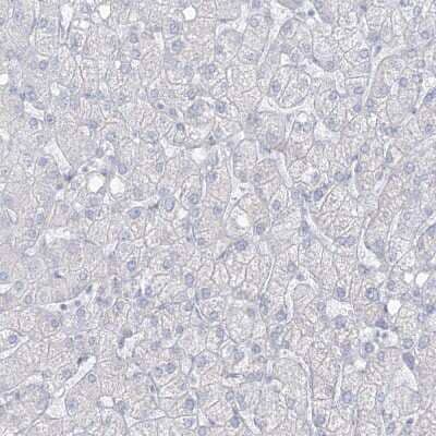 Immunohistochemistry-Paraffin: Transglutaminase 4/TGM4 Antibody [NBP1-86947] - Staining of human Liver shows no positivity in hepatocytes as expected.