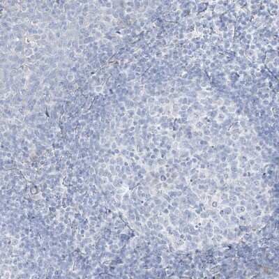 Immunohistochemistry-Paraffin: Transglutaminase 4/TGM4 Antibody [NBP1-86947] - Staining of human Tonsil shows no positivity in non-germinal center cells as expected.