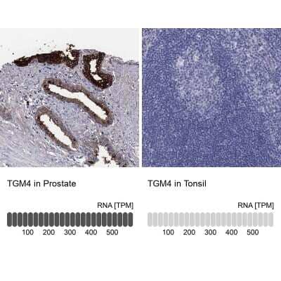 Immunohistochemistry-Paraffin: Transglutaminase 4/TGM4 Antibody [NBP3-17095] - Analysis in human prostate and tonsil tissues using Anti-TGM4 antibody. Corresponding TGM4 RNA-seq data are presented for the same tissues.