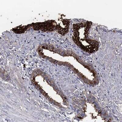 Immunohistochemistry-Paraffin: Transglutaminase 4/TGM4 Antibody [NBP3-17095] - Staining of human prostate shows high expression.