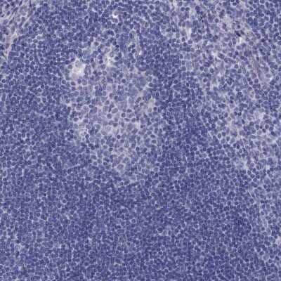 Immunohistochemistry-Paraffin: Transglutaminase 4/TGM4 Antibody [NBP3-17095] - Staining of human tonsil shows low expression as expected.