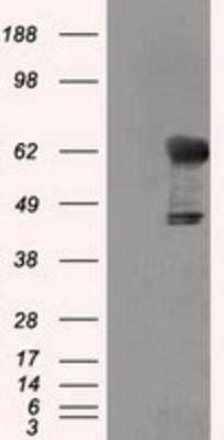 Western Blot: Transketolase Antibody (5H3) [NBP2-02292] - HEK293T cells were transfected with the pCMV6-ENTRY control (Left lane) or pCMV6-ENTRY Transketolase (Right lane) cDNA for 48 hrs and lysed. Equivalent amounts of cell lysates (5 ug per lane) were separated by SDS-PAGE and immunoblotted with anti-Transketolase.