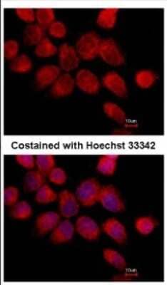 Immunocytochemistry/Immunofluorescence: Transketolase Antibody [NBP2-20699] - Immunofluorescence analysis of paraformaldehyde-fixed A431, using antibody at 1:500 dilution.