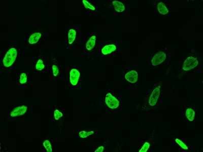 Immunocytochemistry/Immunofluorescence: Transketolase Antibody [NBP2-99344] - Immunofluorescence staining of Transketolase in HeLa cells. Cells were fixed with 4% PFA, permeabilzed with 0.1% Triton X-100 in PBS, blocked with 10% serum, and incubated with rabbit anti-Human Transketolase polyclonal antibody (dilution ratio 1:1000) at 4C overnight. Then cells were stained with the Alexa Fluor(R)488-conjugated Goat Anti-rabbit IgG secondary antibody (green). Positive staining was localized to nucleus.